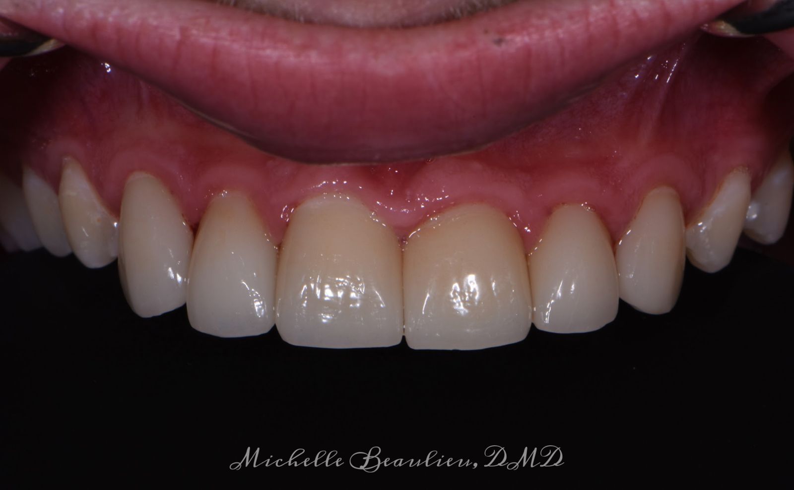 Dr Beaulieu's Work Brightwork Dental Care